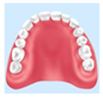 レンジ床義歯