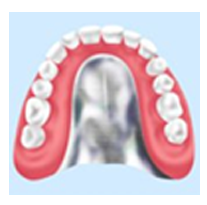 金属床義歯